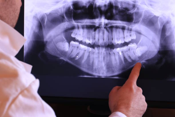 Best Chipped Tooth Repair Near Me  in Orchard Hills, PA