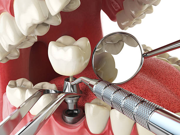 Best Cracked Tooth Emergency Dentist  in Orchard Hills, PA